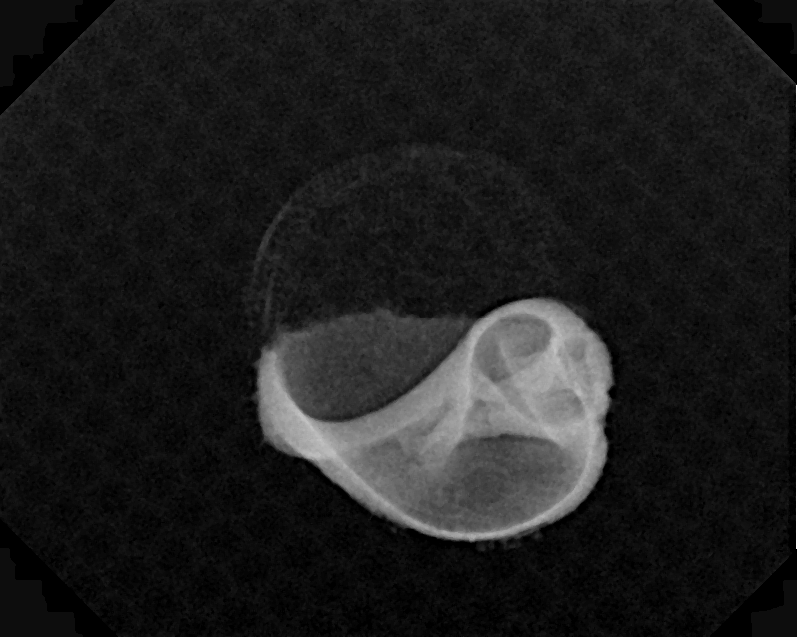 X-ray small shell