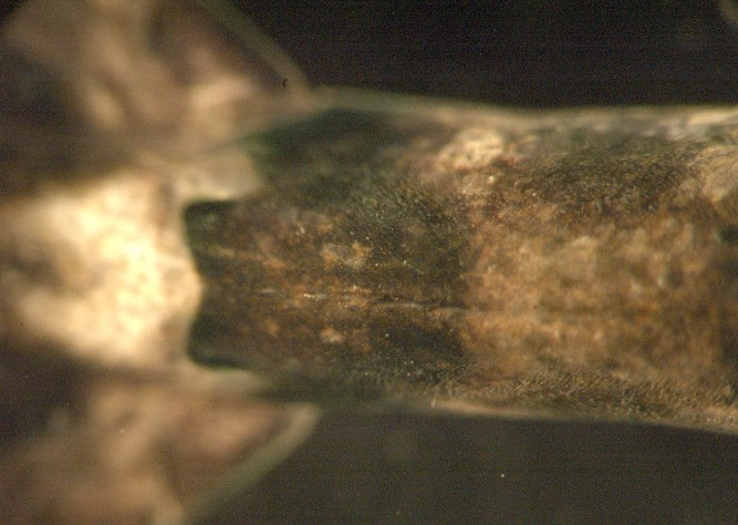 Abdominal segment 6 dorsal