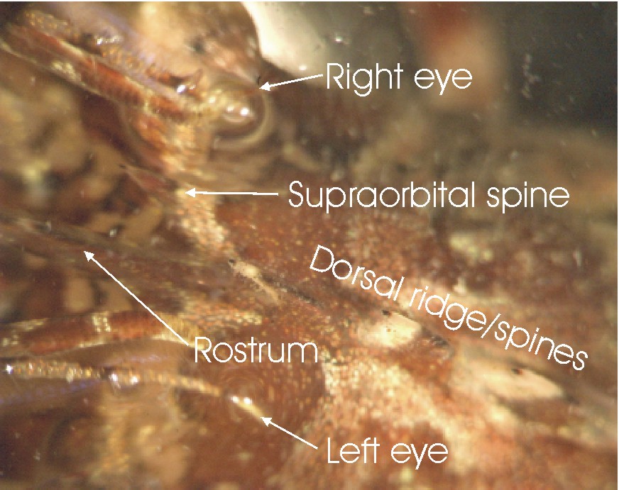 Supraorbital spine