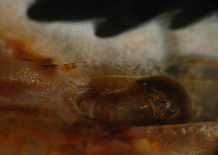 Supraorbital spines