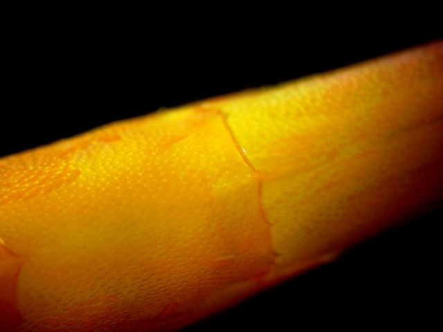 Abdominal segments 5-6 dorsal view