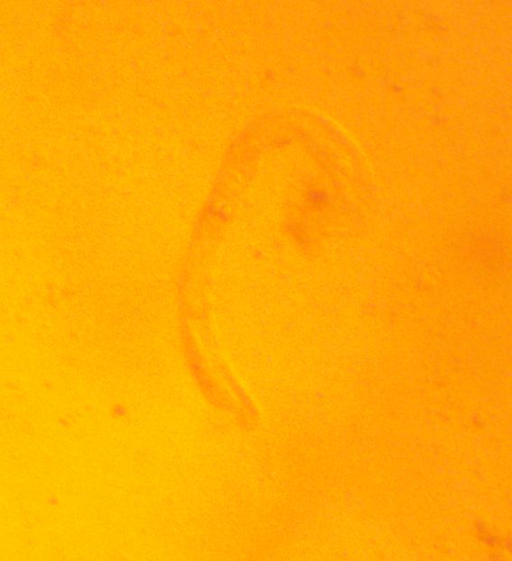Dicyemid