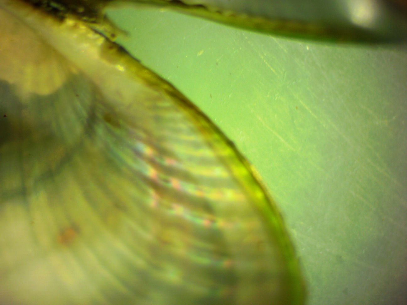 Anterior internal ridges